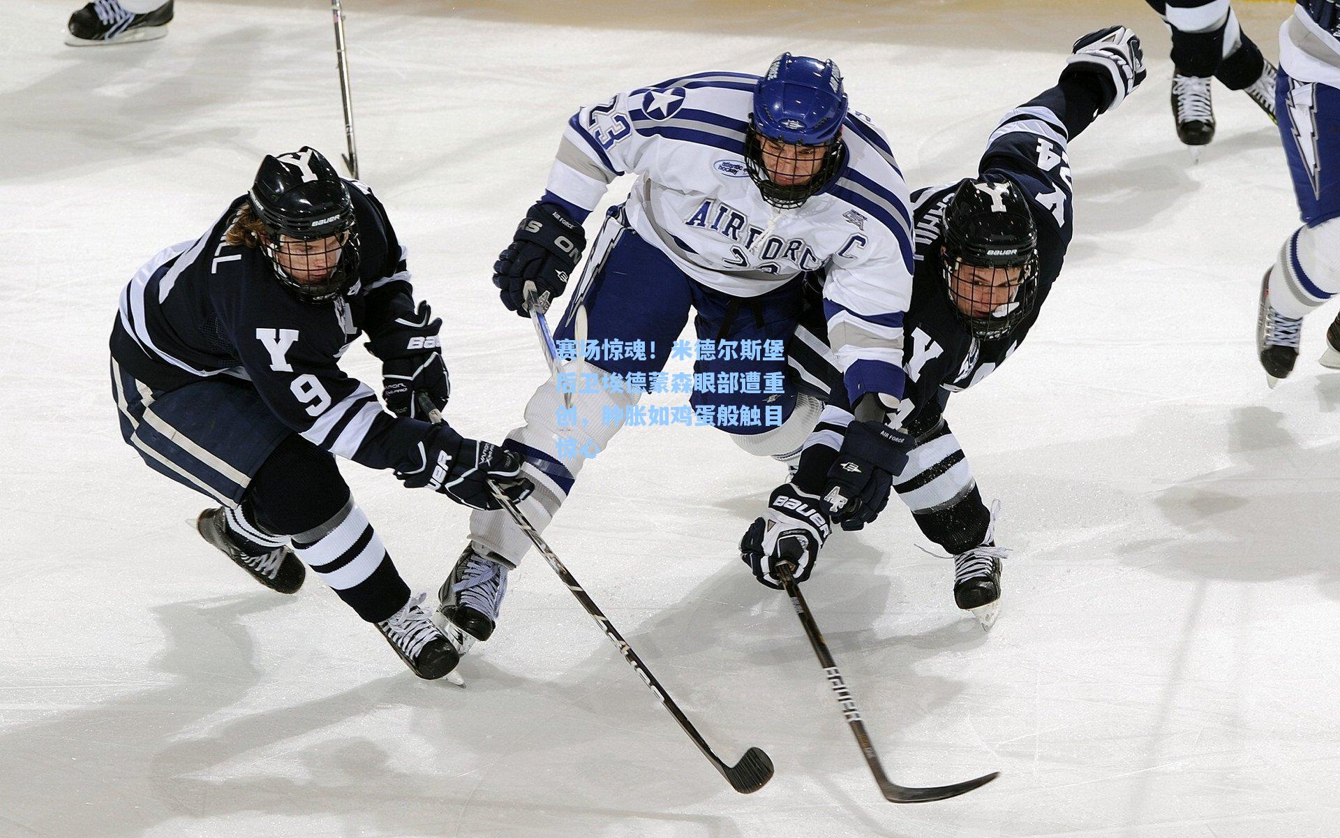 赛场惊魂！米德尔斯堡后卫埃德蒙森眼部遭重创，肿胀如鸡蛋般触目惊心
